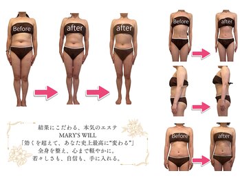 マリーズウィル(MARY's WILL)/寝ながら全身バランス矯正★