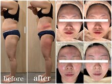 リボディ プラチナ(Rebody platinum)