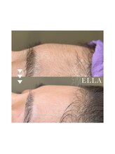 エラ(ELLA)/美肌フェイシャルワックス