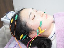 サロン ド ハリッシュ(Salon de HARISH)/電気を流す美容鍼