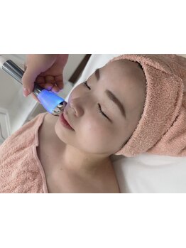 小顔になりたい