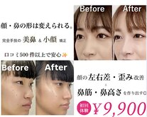 ラプリ 新宿店(Raplit)