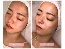 セレニティ バイ マリ(Serenity by Mari)/