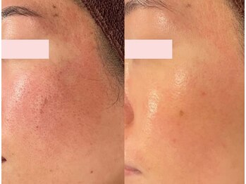 ミレット(Miretto)/