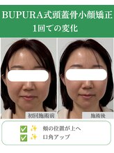 ブプラ 代々木上原店(BUPURA)/小顔×むくみ改善