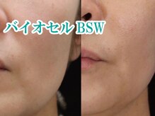 美宝 元町/美宝、最高峰エステ