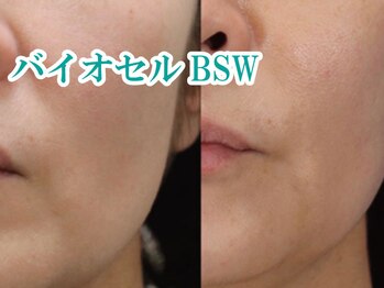 美宝 元町/美宝、最高峰エステ