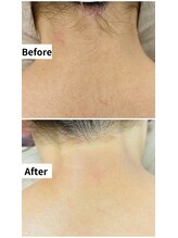 ブロン(Blanc)/お任せください♪