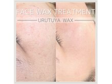 シー(Siiii)の雰囲気（産毛や角質がなくなることで潤艶肌へ。）