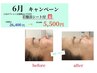 30名様限定★たるみ・シワ改善◎ 根本改善!! 水素フェイシャル 水素吸入付♪