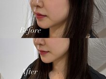 ハクト(Hakuto)/Before/After