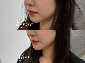 ハクト(Hakuto)/Before/After