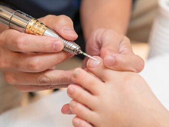 ビオプラス そごう横浜店(bioplus)の写真/《綺麗な仕上がりが評判☆》特許取得の補正技術で巻き爪の痛みを早期に改善♪距骨とセットで再発防止もOK