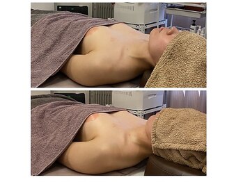 ベンザイ 新潟店(BENZAI)/首こりから顔のむくみ、赤み