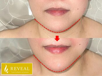 リヴェール 田無店/ビフォーアフター