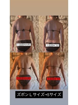 チルミー(chill me)/１回目→３回目のビフォアフ