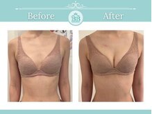 美人バスト 新潟店/ 【バストアップ★育乳】症例