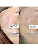 ブラックボックス(BLACK BOX)/30代女性のお客様