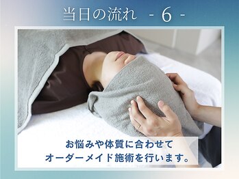 カーム(calm)/当日の流れをご案内します(6)