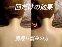 EMI 上野店/＃首肩のつらさを改善したい