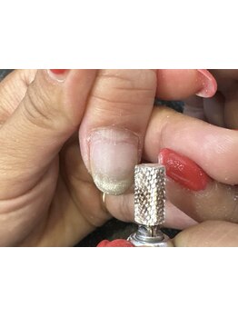 爪の悩みを解消できる（ケア含む）