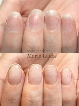マリーロール 淀屋橋本店(Marie Laure)/自爪育成/深爪矯正/ネイルケア