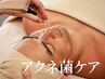 【メンズ特化◆ニキビケア】25歳からのアクネ菌撃退ケア＋毛穴洗浄60分￥6600
