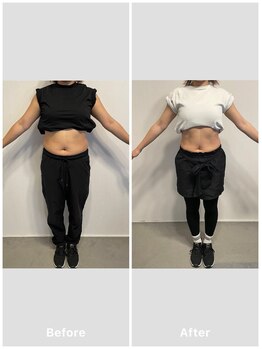 グレイス(Grace)/【ビフォーアフター】