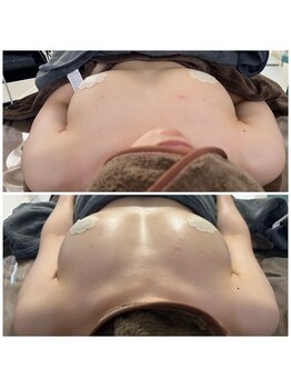 モア(moa)/驚きのビフォーアフター！