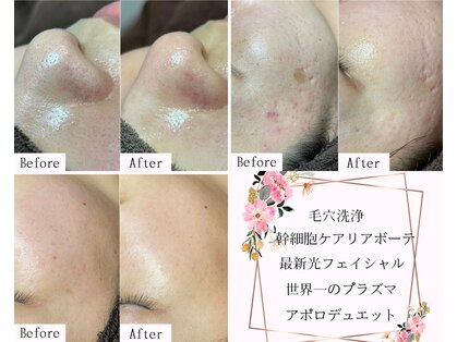 サロン ド フィエルテ(サロン ド・フィエルテ)の写真