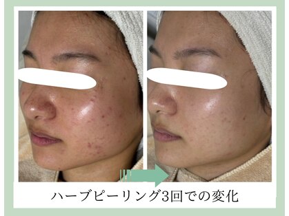 ルーセントの写真