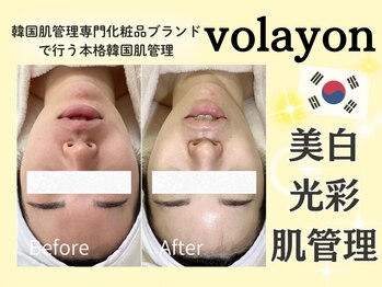ヘティ バイ ソウル 中目黒(HETIY by Seoul)の写真/【本格韓国肌管理◆ツヤ白玉*陶器肌】韓国肌管理専門化粧品ブランドで行う徹底美白ケア☆