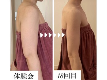 ブリランテ(Brillante)/