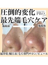 ピュール 鯖江店(PUR)/毛穴/毛穴ケア/毛穴洗浄