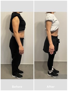 グレイス(Grace)/【ビフォーアフター】