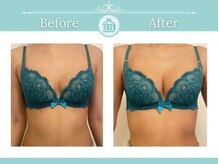 美人バスト 新潟店/ 【バストアップ★育乳】症例