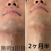 紫苑