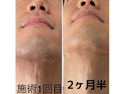 紫苑の写真
