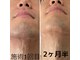 紫苑の写真