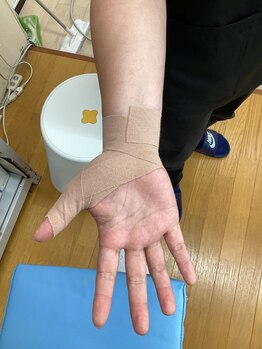 おなが浦添当山整骨院/手首の痛み