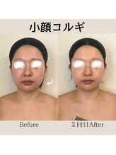 リーブル(LIBRE)/小顔コルギ　２回