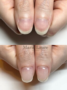 マリーロール 淀屋橋本店(Marie Laure)/自爪育成/深爪矯正/ネイルケア
