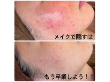 ポアレ(POARE)の雰囲気（メイクで隠す日々は卒業できる！鏡を見るのも毎日楽しくなる！）