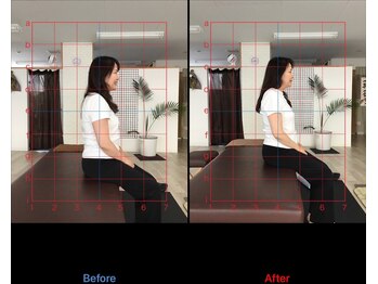 ストレチックス 近江八幡店/BeforeAfter