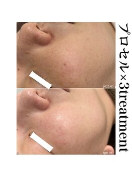 ヒルナム(Heal Nam)/プロセルセラピーズ~フェイス~