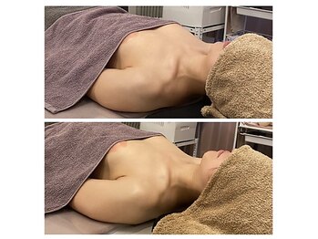 ベンザイ 新潟店(BENZAI)/乾燥赤み毛穴、体の巡りが原因？