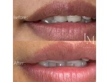 ピュアソル 奈良店(Puresol)/ルメラ