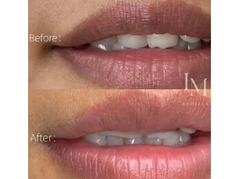 ピュアソル 奈良店(Puresol)/ルメラ