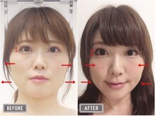 さつま骨格矯正 表参道青山院/歪み小顔矯正＋骨盤矯正