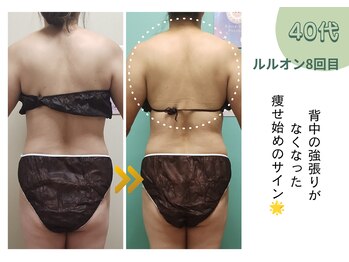 ヨサパーク ミミ 高野店(YOSA PARK mimi)/ビフォーアフター